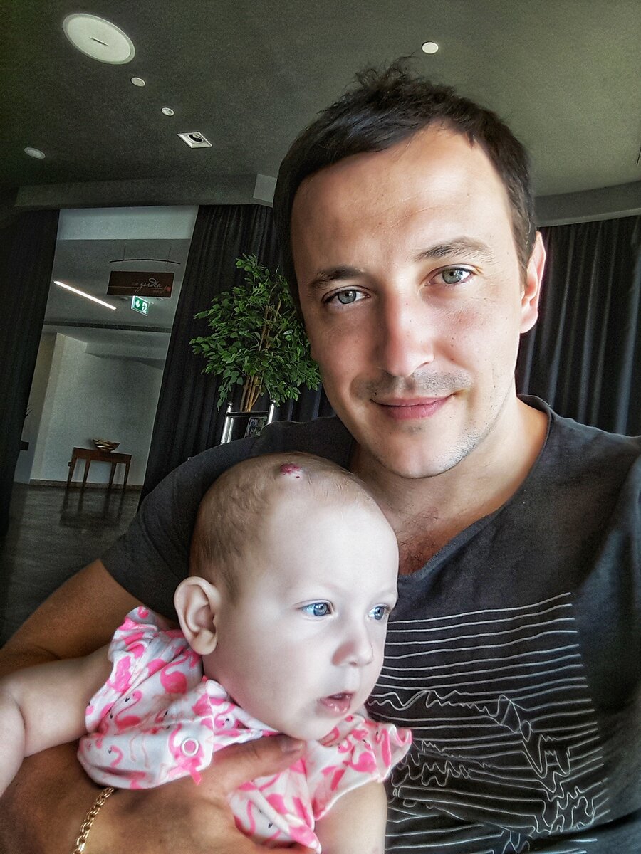 Февраль 2019 г, "Гемангиому видно невооруженным взглядом"