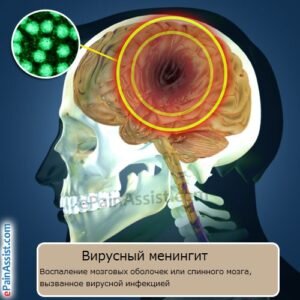 В отличие от гнойной формы менингита, имеющего бактериальное происхождение, данную разновидность болезни характеризует вирусная этиология, которая сопровождается опасным серозным воспалением. Основным признаком серозного воспалительного процесса считается развитие серозного выпота в области мозговых оболочек, что приводит к их утолщению.