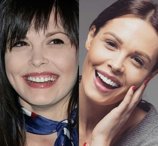 Зуб на зуб не попадает: знаменитости с некрасивой улыбкой, которую они исправили