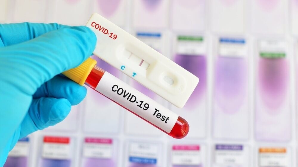 "Тест на COVID-19". Изображение взято из открытых источников Internet