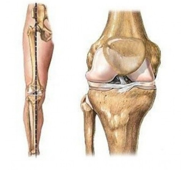 Нормальный коленный сустав. Механическая ось проходит через центр сустава
