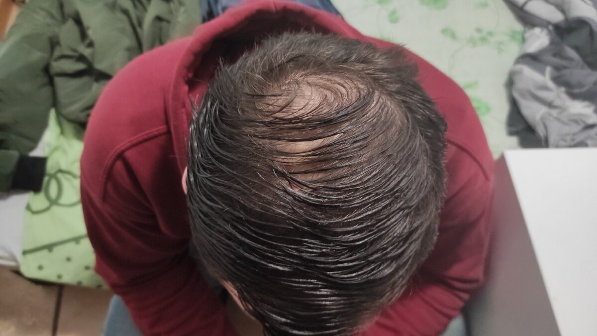 Вот и я столкнулся с этой проблемой