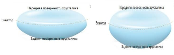 https://mgkl.ru/assets/images/hrustalik-glaza.jpg