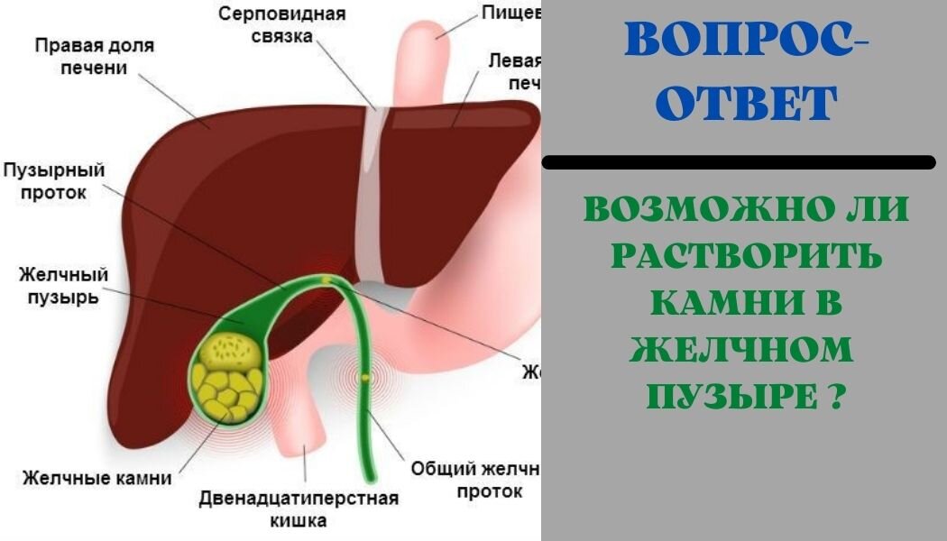 Как живете без желчного пузыря отзывы