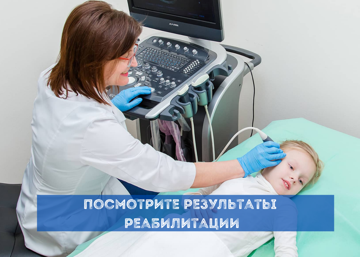 УЗИ сосудов головы и шеи