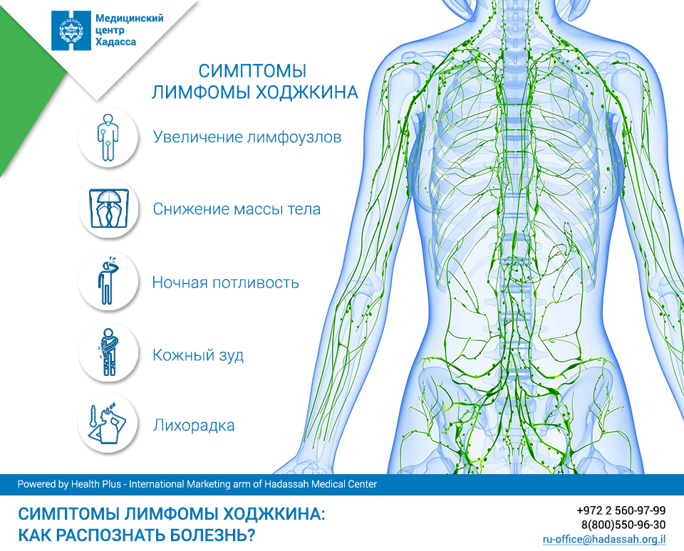 Лимфома Ходжкина: симптомы, прогноз на 4 стадии и лечение.