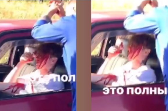 Фото: сторис в Instagram