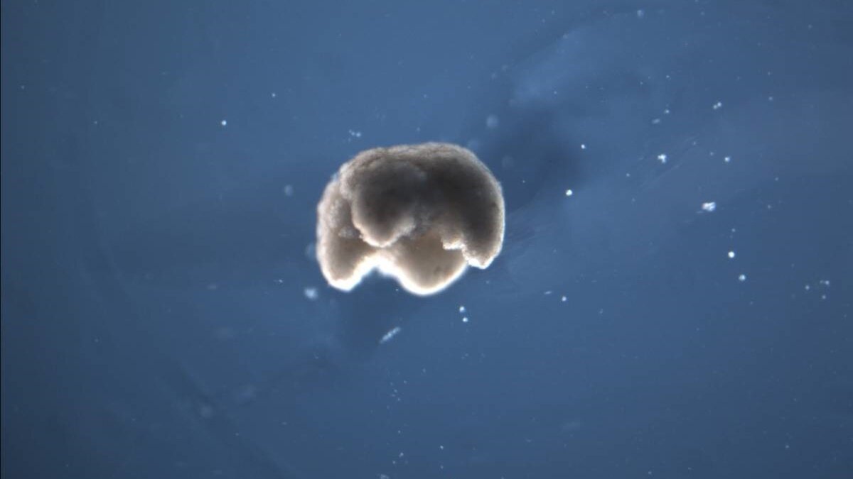 Ксенобот имеет диаметр 650-750 микрометров. Фото Douglas Blackiston, Tufts University.