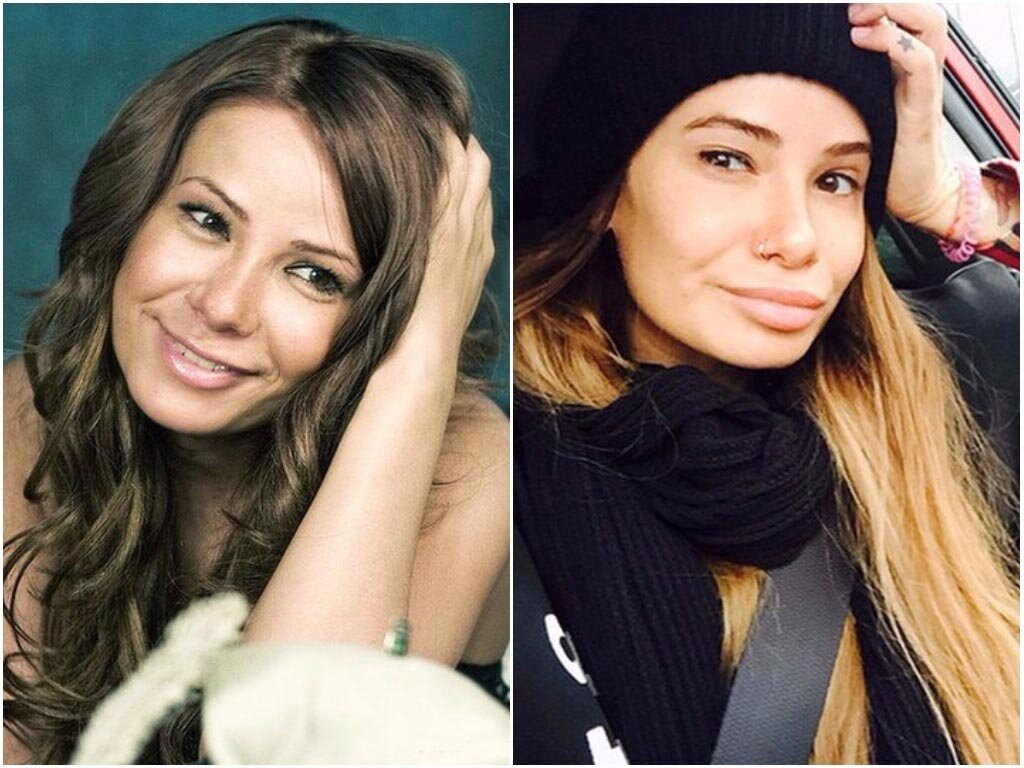 Айза анохина до и после пластики фото
