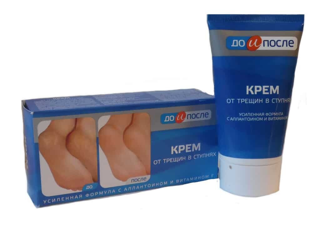 крем для ног от трещин в ступнях