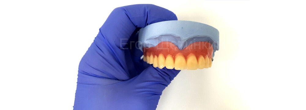 Частичный съёмный зубной протез