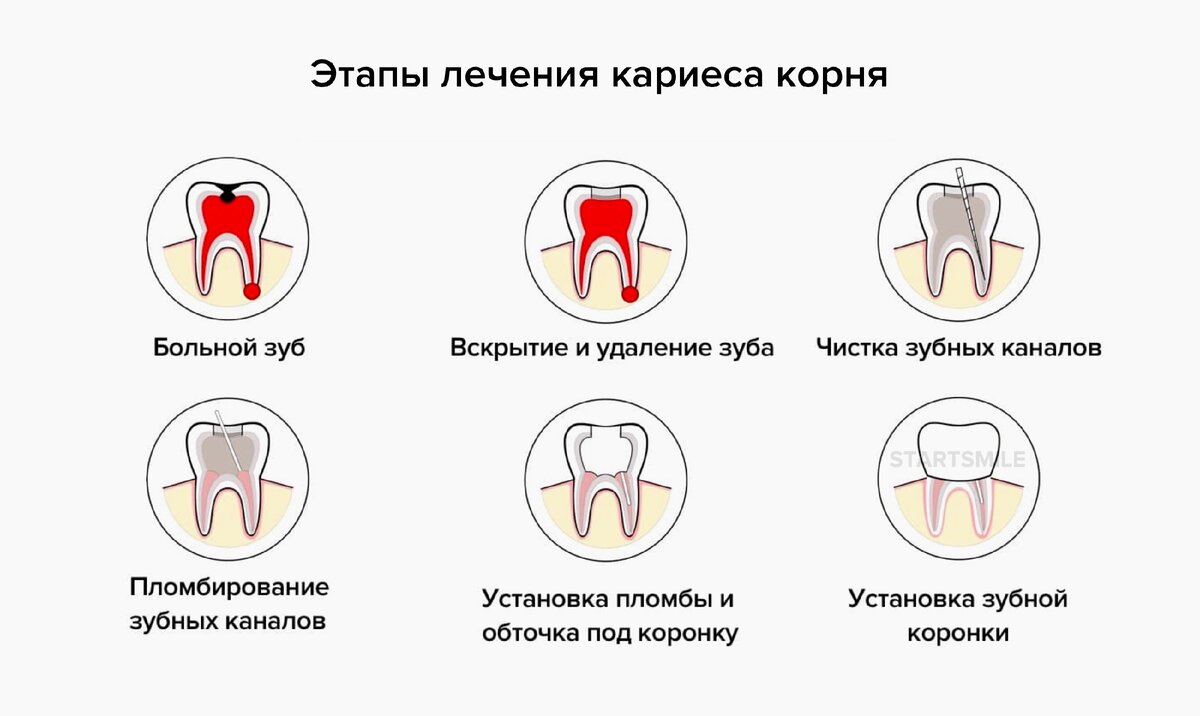 Формирование корня зуба