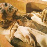 3,000 До нашей эры – Применение антисептиков, таких как смолы или смолы, смолы и ароматические соединения широко используются египтянами в бальзамировании тела, даже прежде, чем они написаны языком. Они были также ознакомлены с антисептиком значением сухости в результате использования определенных химических веществ, таких как селитры и поваренной соли. Они стали настолько умелы в искусстве бальзамирования, что мумии тысяч лет все еще в хорошем состоянии.