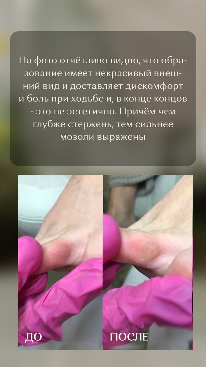 -2-2