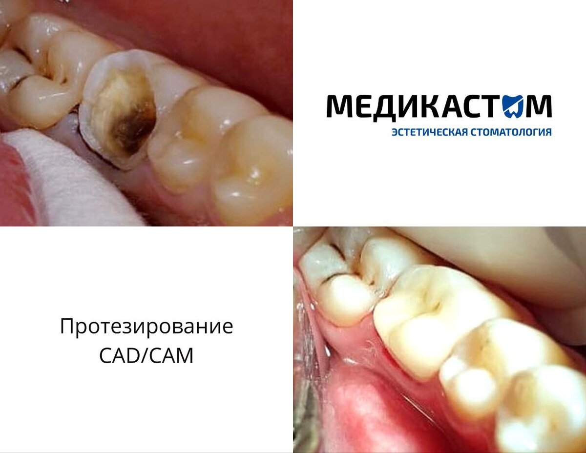 Результат будет качественным, точным и эстетичным! 
