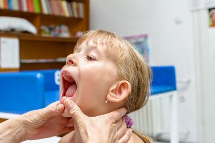 Согласно статистике болезни пульпы сегодня выявляются у 28–30 % детей всех возрастных групп.-4
