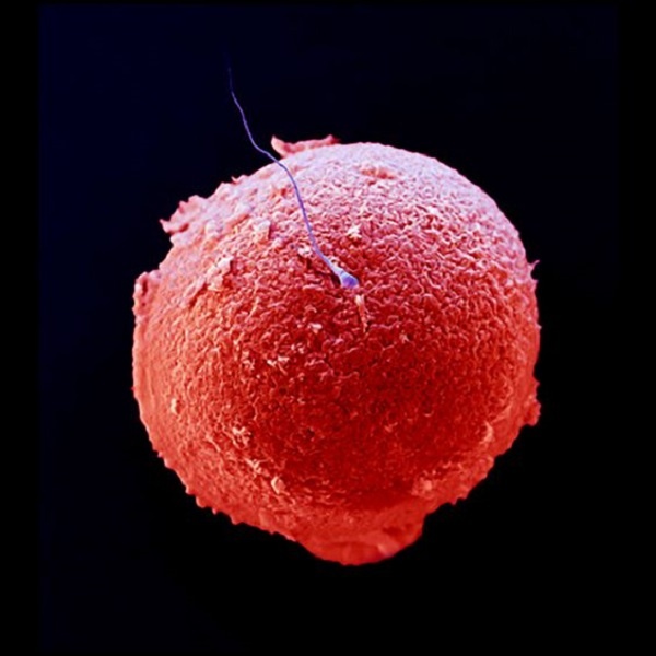 Оплодотворенная яйцеклетка. Источник – https://www.pinterest.ru/pin/658862620470683493/