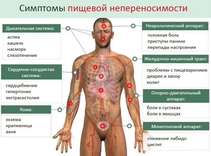 Аллергическая крапивница