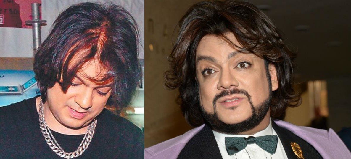 Филипп Киркоров и его прически. Фото yandex.ru