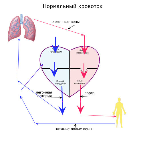 Нормальный кровоток 