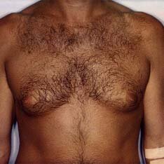 Мужская грудь. И это можно показывать и ходить так на пляже!