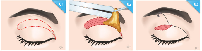 ДЛЯ МЕНЯ ДАЖЕ НА КАРТИНКАХ ВЫГЛЯДИТ НЕПРИТНО!