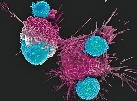 Как лейкоциты борются с раком