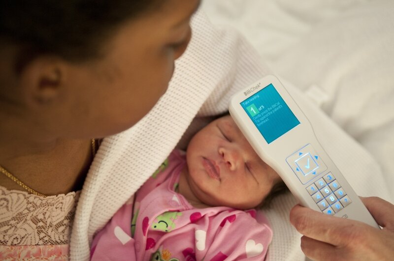 Philips Bilichek (новый гаджет стоит от $5к, поэтому встретить вы его можете только в роддомах)