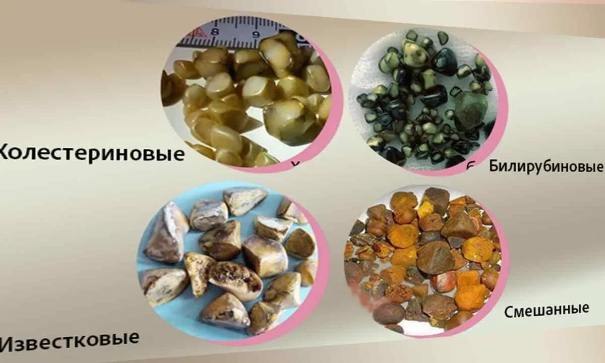 Иллюстрация взята с сайта яндекс Картинки