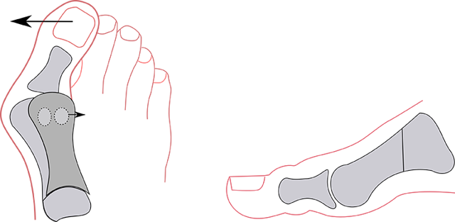 Механизм образования