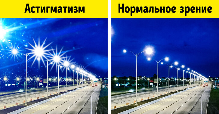 Как выглядит астигматизм глазами человека