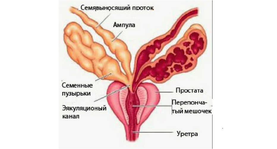 Везикулит предстательной железы. Предстательная железа и семенные пузырьки анатомия. Семенной проток анатомия. Строение предстательной железы и семенных пузырьков. Семенной пузырь анатомия.