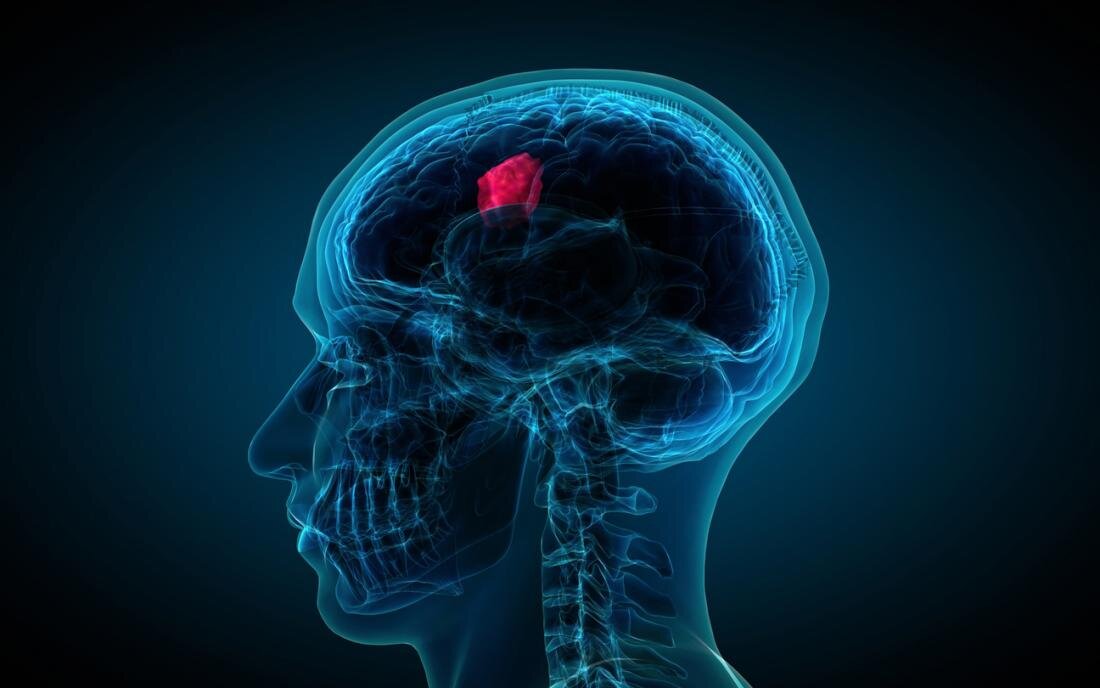 Фото: https://www.medicalnewstoday.com