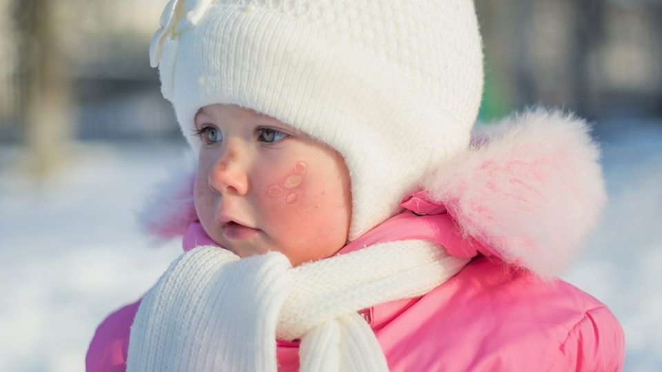 Первая помощь при переохлаждении и обморожении ребенка
