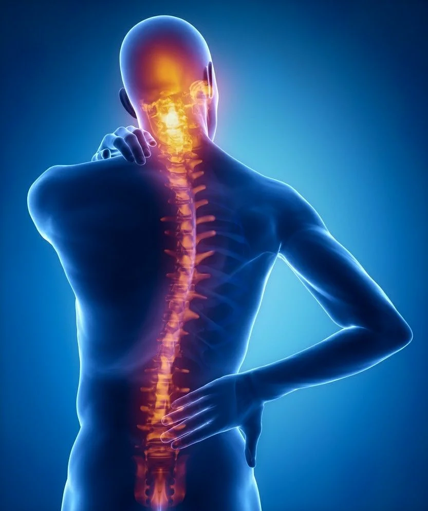 Болей спины связаны с. Острый поперечный миелит. Миелит спинного мозга. Поперечный миелит спинного мозга. Идиопатический миелит.