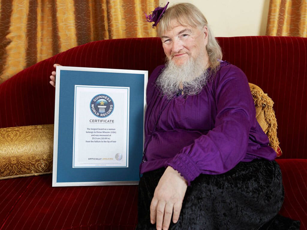 Женщина совсем не стесняется лишней растительности