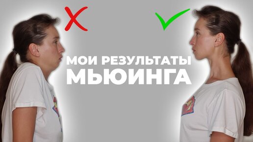 Download Video: Изменил ли мьюинг моё лицо? Рассказываю, как я держу язык за зубами, чтобы хорошеть