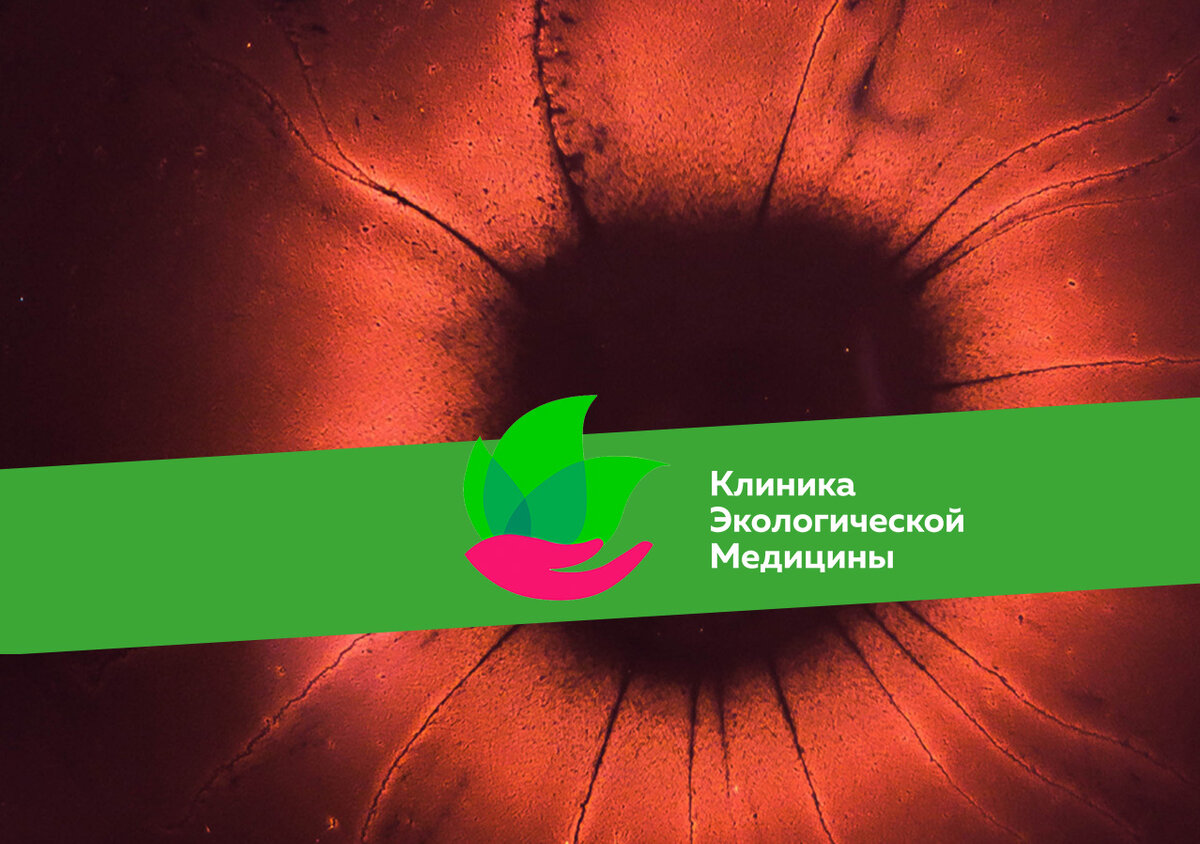 Микрофлора кишечника играет важную роль в работе организма