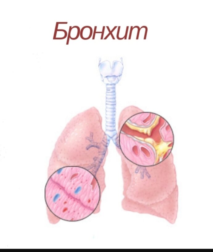 Вот так он выглядт внутри человеческого тела 