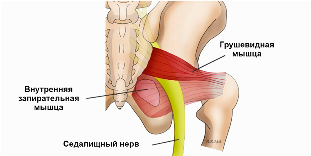 Боль, исходящая от мышц и/или суставов таза или бедра, может распространяться вниз по ноге и также может оказывать влияние на стопу.-2