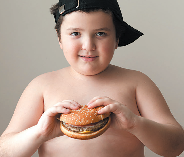 Проблема детского ожирения и его профилактика