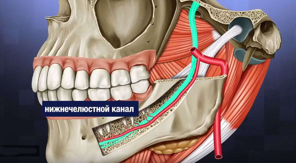 Зубы мудрости: когда и как удаляют, противопоказания