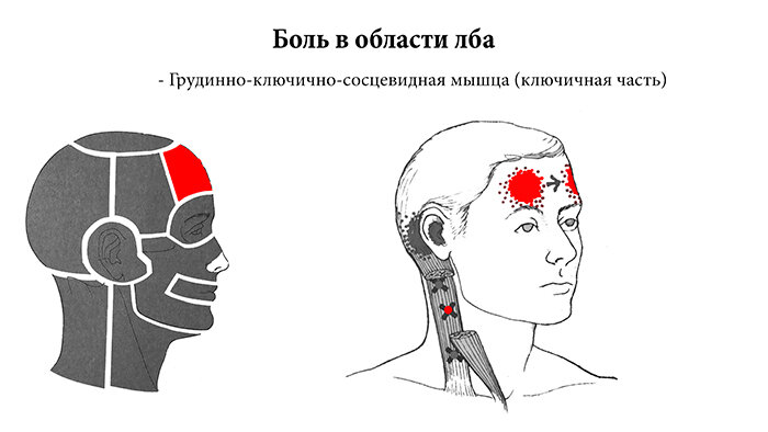 Почему болит лоб