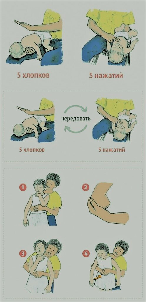 Как оказывать помощь, если ребенок подавился.