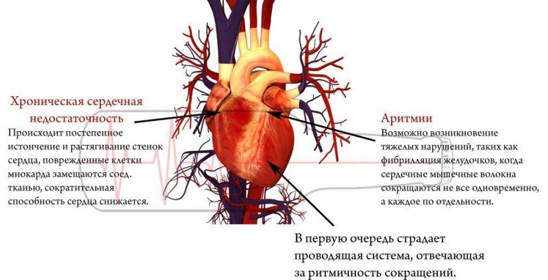 Тахикардия после алкоголя