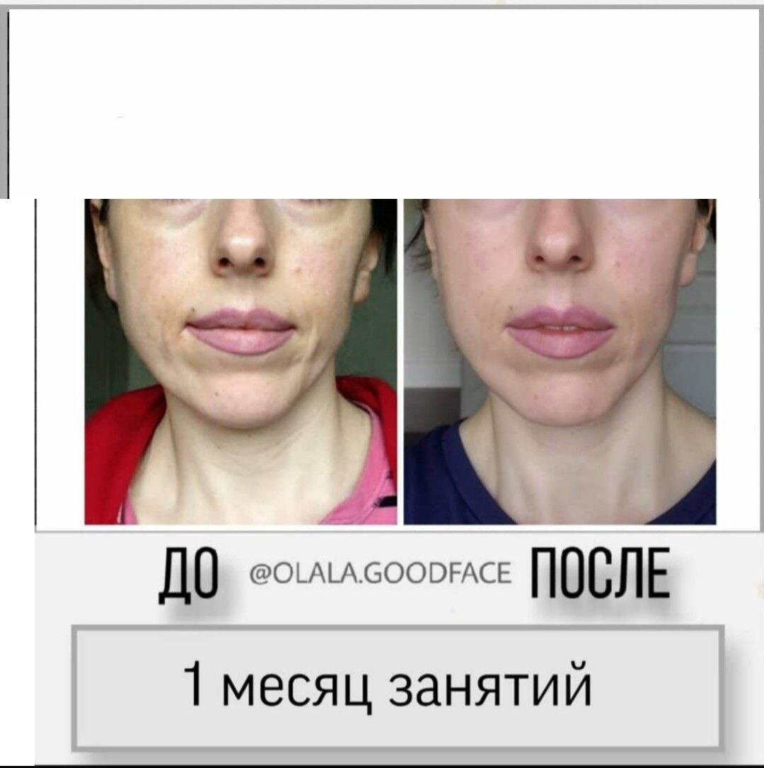 Упражнения для челюсти. Упражнения для мышц выдвигающих нижнюю челюсть. Упражнения при открытом прикусе для ребенка. Упражнения для нижней челюсти для детей. Миогимнастика внчс упражнения.