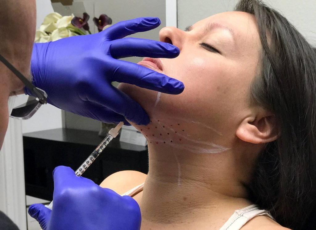 Мезотерапия подбородка (Источник картинки - https://goo.su/66fO)