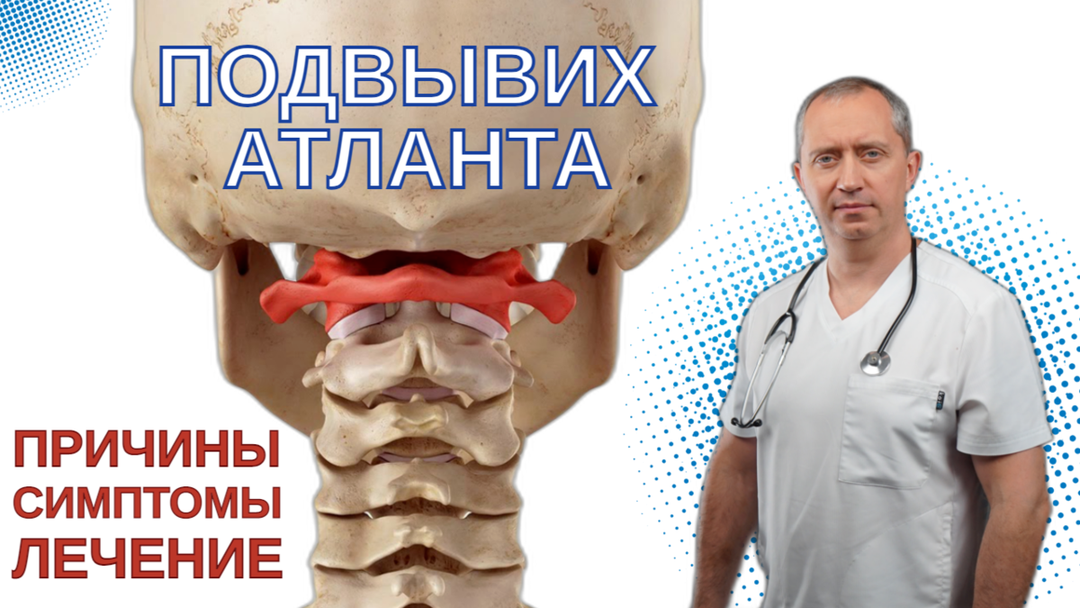 Подвывих атланта: что это и как лечить? Эффективна ли правка атланта? |  Блог Доктора Шишонина | Дзен