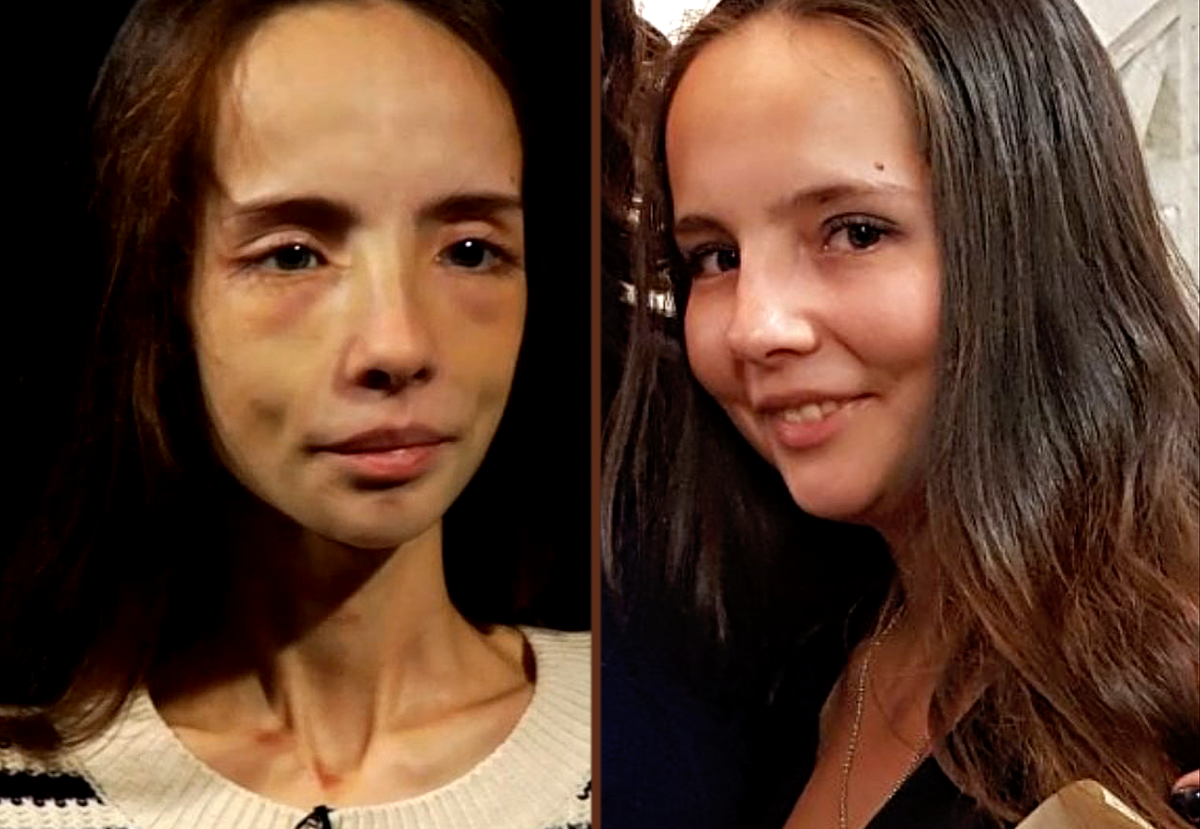 Анорексичка из битвы экстрасенсов. Катя Яковлева битва экстрасенсов. Битва экстрасенсов анорексия Катя Яковлева. Катя Яковлева анорексия. Битва экстрасенсов Анорексичка Катя.