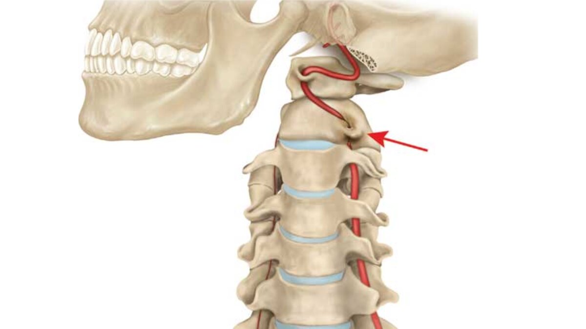 Аномалия шейного отдела позвоночника